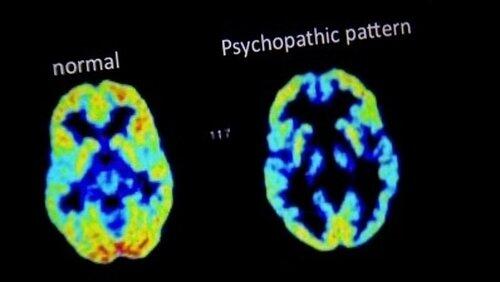 What Makes a Psychopath? What Makes a Psychopath?