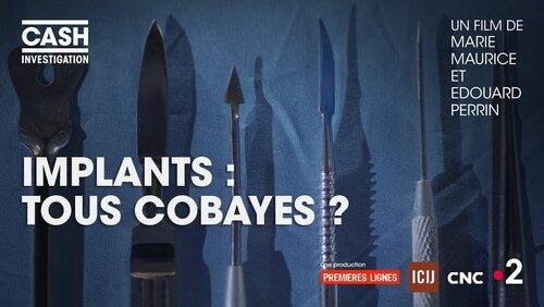 Implants : tous cobayes ? Implants : tous cobayes ?