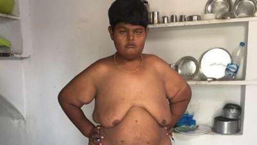 Boy with no eyes Boy with no eyes