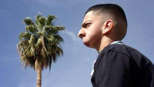 Boy with no Jaw Boy with no Jaw