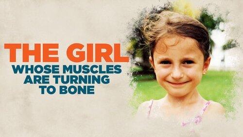 The Girl Whose Muscles are Turning Into Bone The Girl Whose Muscles are Turning Into Bone