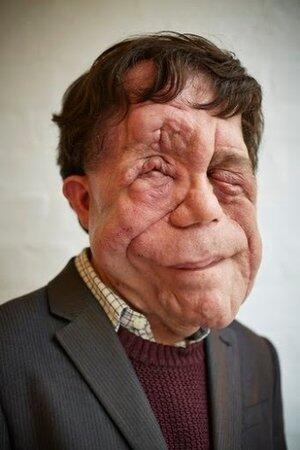 photo of Adam Pearson photo of Adam Pearson