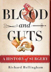 Blood and Guts: A History of Surgery Blood and Guts: A History of Surgery