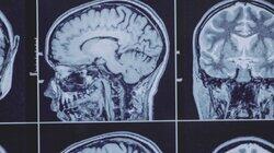 Unlocking the Sixth Sense