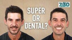 Super or Dental? Super or Dental?