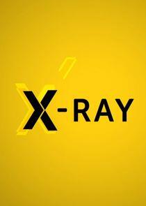 X-Ray X-Ray