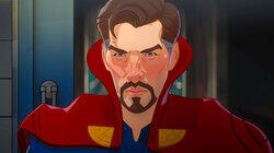 What If… Doctor Strange Lost His Heart Instead of His Hands? What If… Doctor Strange Lost His Heart Instead of His Hands?