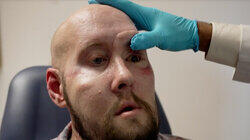 Eye on America: Man receives eye transplant Eye on America: Man receives eye transplant