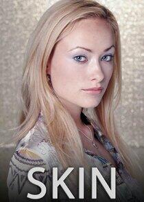 Skin Skin