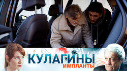 Импланты Импланты
