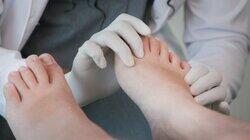 Sixth Toe Surprise Sixth Toe Surprise