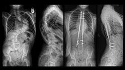 The Great Implant Scandal The Great Implant Scandal