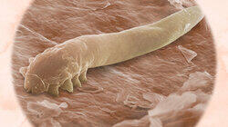 Your Skin Your Skin