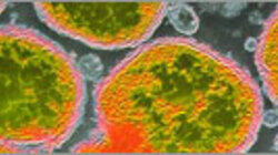 Killer Disease on Campus Killer Disease on Campus